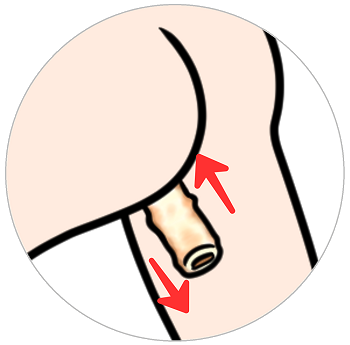 suction-hole-option3